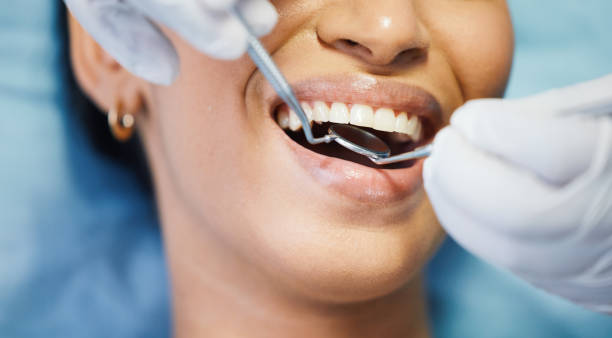 Best Knocked-Out Tooth (Avulsed Tooth) Treatment in Plymouth, MN